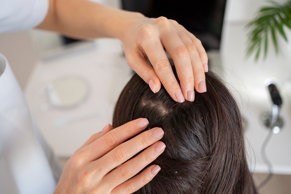 close up doctor treating dandruff